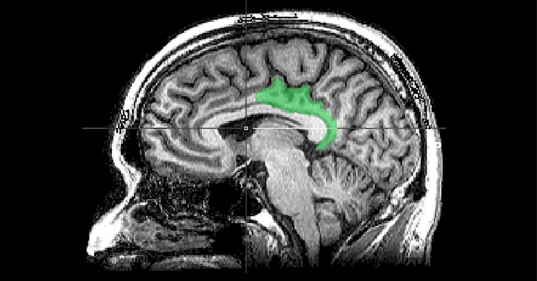 Neuroscience of trauma