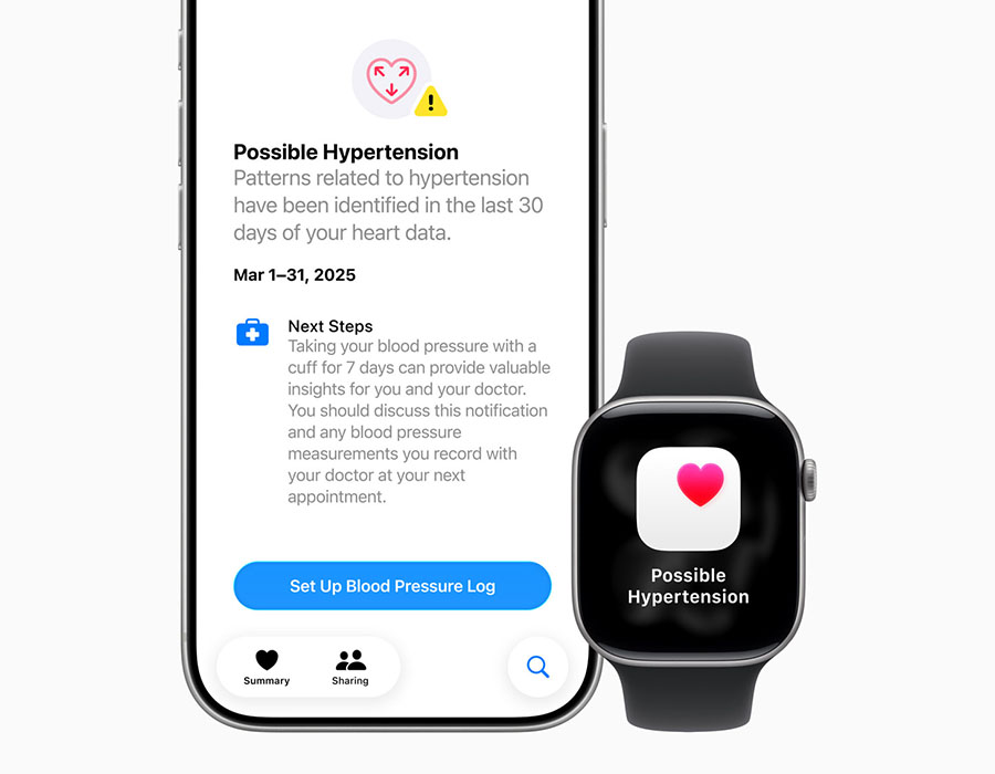 Apple Watch Series 11 with Hypertension Notifications